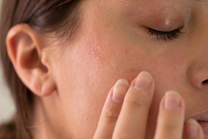 Bỏ qua dưỡng ẩm sau tẩy da chết làm mất nước, khiến da kích ứng và khô ráp.