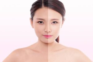 Tại sao da lúc trắng lúc đen: 7 nguyên nhân phổ biến