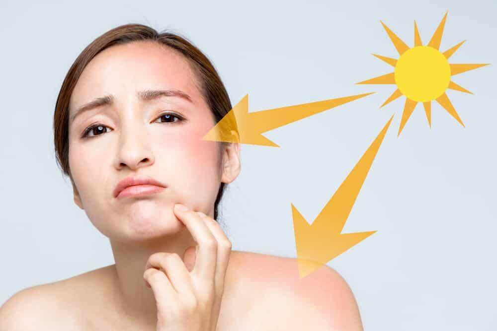 Mất bao lâu để da trắng trở lại? Hướng dẫn chính xác từ chuyên gia